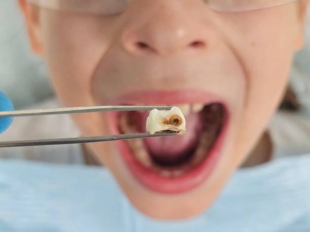 Best Weekend Emergency Dentist in Carrizo Hill, TX
